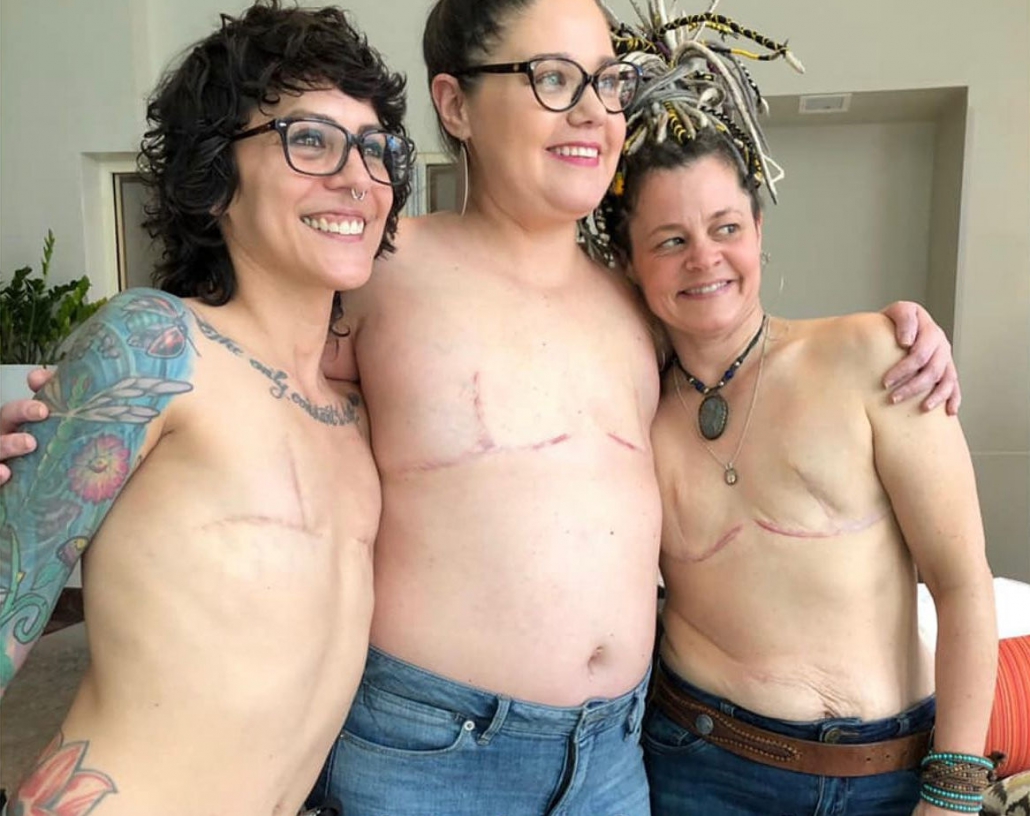 Breast Reconstruction After Mastectomy